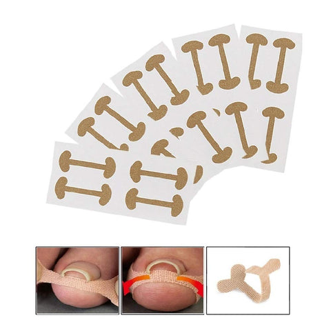 EBANKU 5 Sheets/20 Pcs Ingrown Toenail Corrector Stickers, Toe Nail Treatment Elastic Patch Sticker Corrector Pedicure Tools Fingernail Toe Nail Care Protects Toe Nail