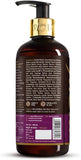 WOW Skin Science Red Onion Black Seed Oil Shampoo with Red Onion Seed Oil Extract, Black Seed Oil & Pro-Vitamin B5 - No Parabens, Sulphates, Silicones, Color & PEG - 300mL